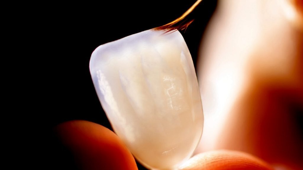 Lentes de Contato Dentárias